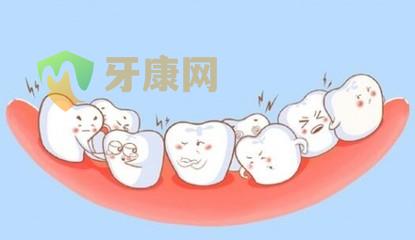 牙齒過于擁擠怎么辦