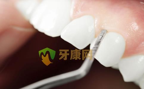 洗牙和冷光美白的區別