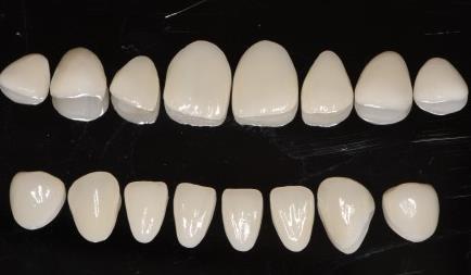 不同形狀的瓷貼面