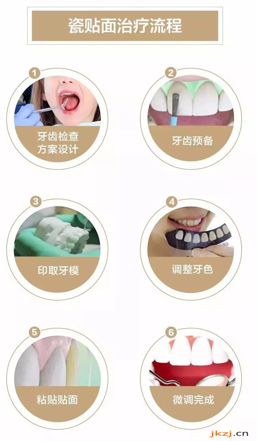 輕度四環(huán)素瓷貼面美白價(jià)格