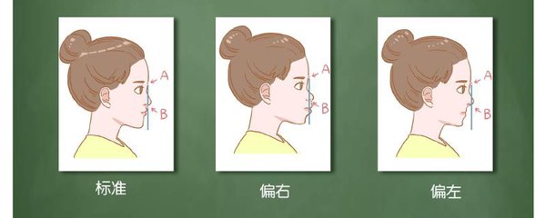 牙性齙牙與骨性齙牙圖