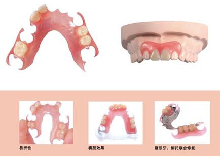 鑲活動義齒修復