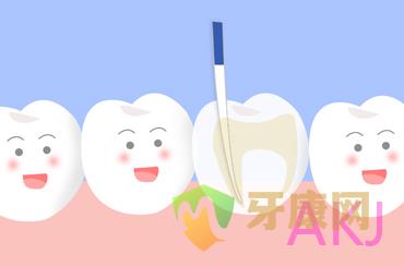 牙齒根管治療 牙齒根管治療